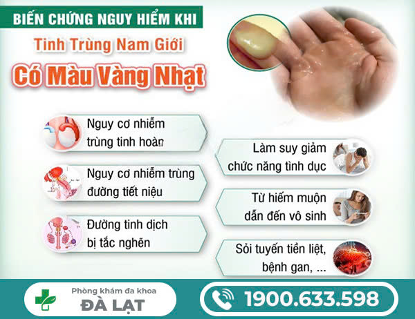 Hình ảnh minh họa